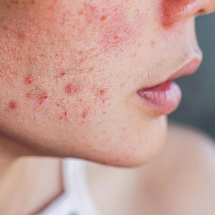 Transformez votre peau avec des traitements dermo-esthétiques personnalisés