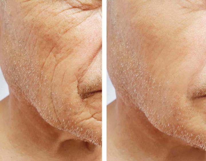 Traitements anti-âge pour le visage Caen